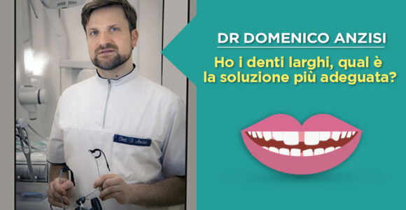 dr-domenico-anzisi-denti-larghi-o-diastema