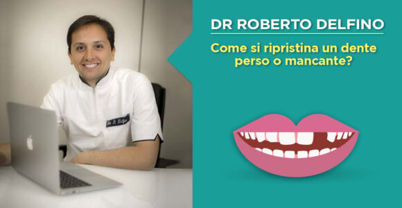 dr-roberto-delfino-napoli-rimpiazzare-dente-mancante