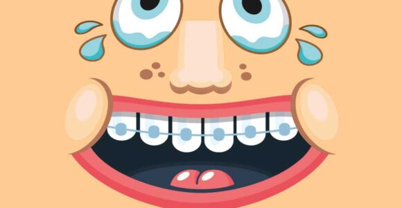 Scovolino dentale: come usarlo e quale scegliere - Studio Dentistico  Delfino Anzisi