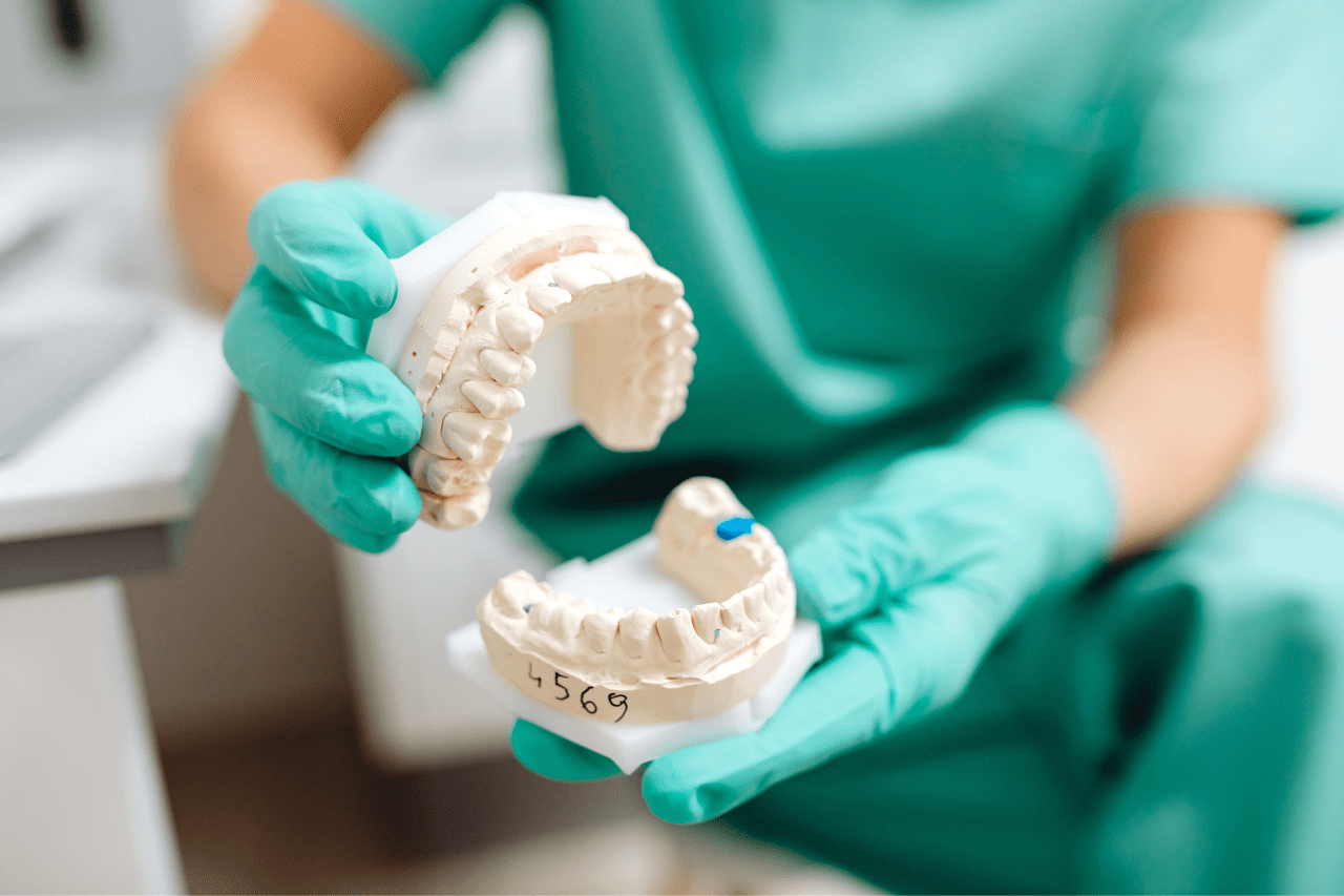 La malocclusione dentale: cos'è e come si cura